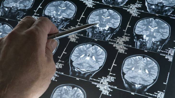 Brain-based arguments are changing the way we think about guilt, mental and emotional injuries. Photo: iStock