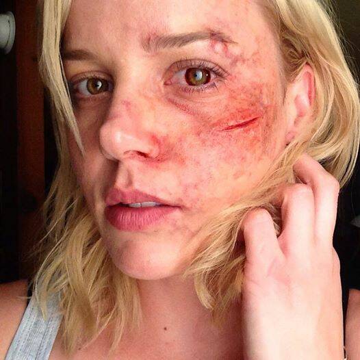 OUCH: Lochinvar actress Abbie Cornish dons special make-up for a role.