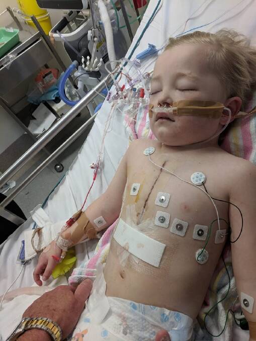 LITTLE FIGHTER: Marcus Dunn pictured just a few hours after his life saving surgery.