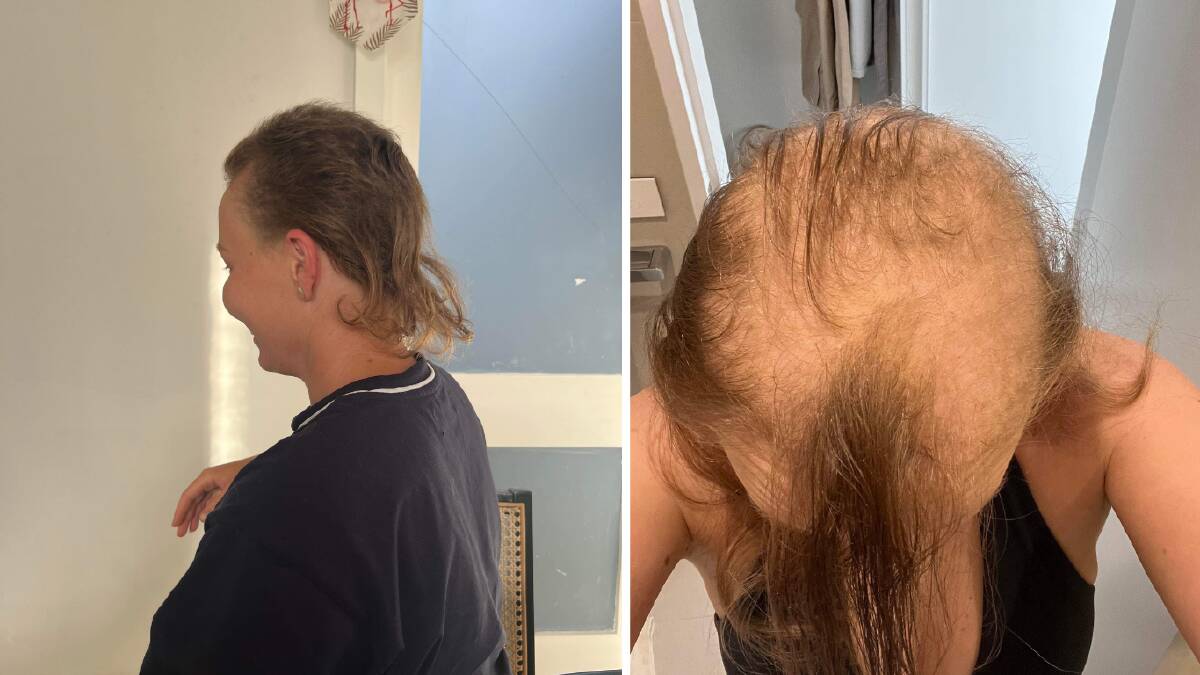 Emma Baillie is entering Mulletfest with her unexpected hairstyle after chemotherapy to treat breast cancer. Pictures supplied